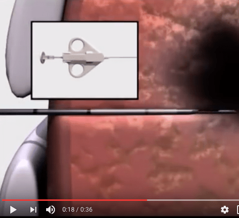 Screenshot 2019-03-15 at 5.53.06 PM